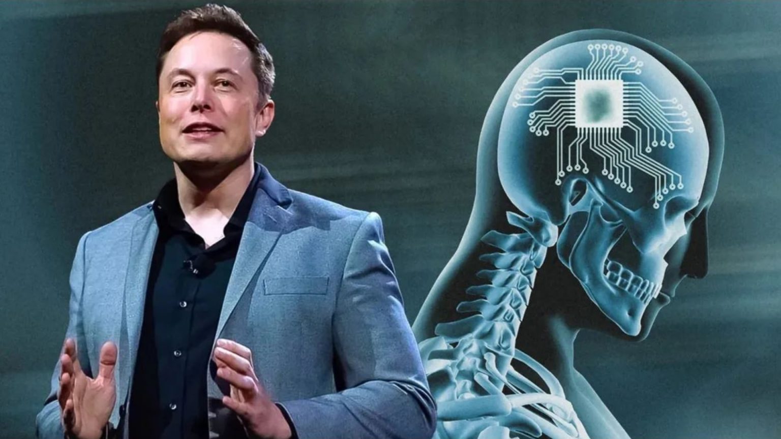 Kezdődhetnek az emberkísérletek az agyba ültetett chipekkel Elon Musk cégénél